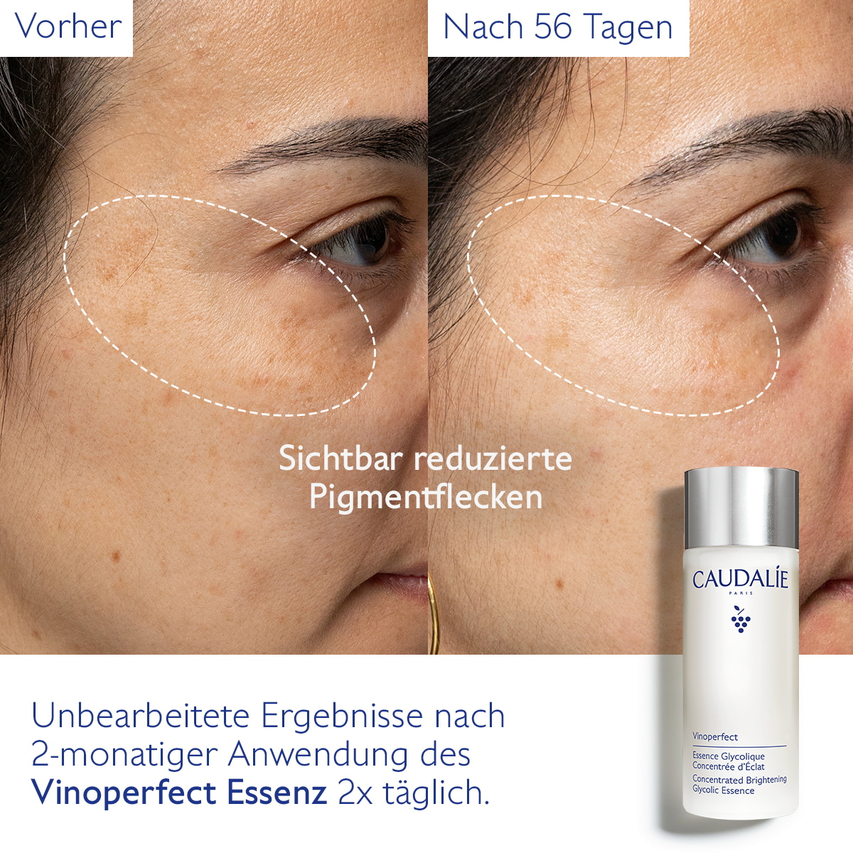 Essenz mit Glykolsäure für mehr Ausstrahlung