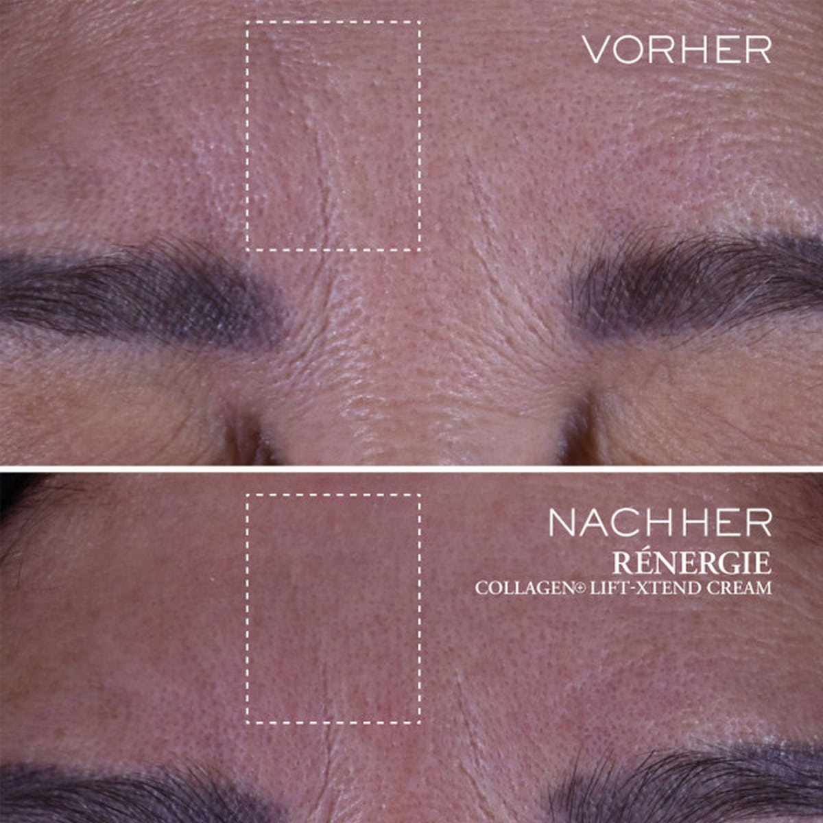 Rénergie Collagen Lift-Xtend Cream