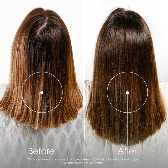 Shampoo for Hair Loss