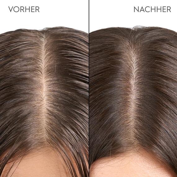 Exfoliating Scalp & Hair Treatment