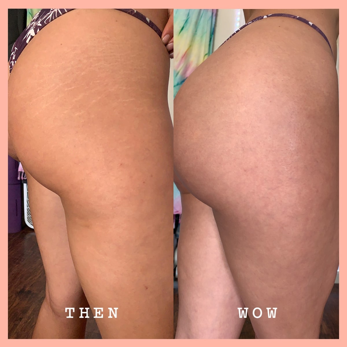 Rosehip Body Scrub & Cleanser