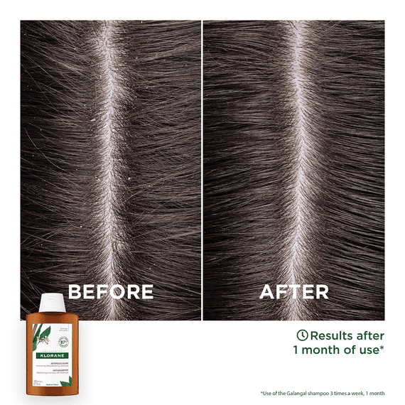 Anti-Dandruff Shampoo
