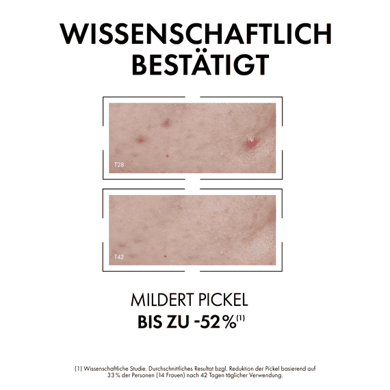Sérum anti-imperfections