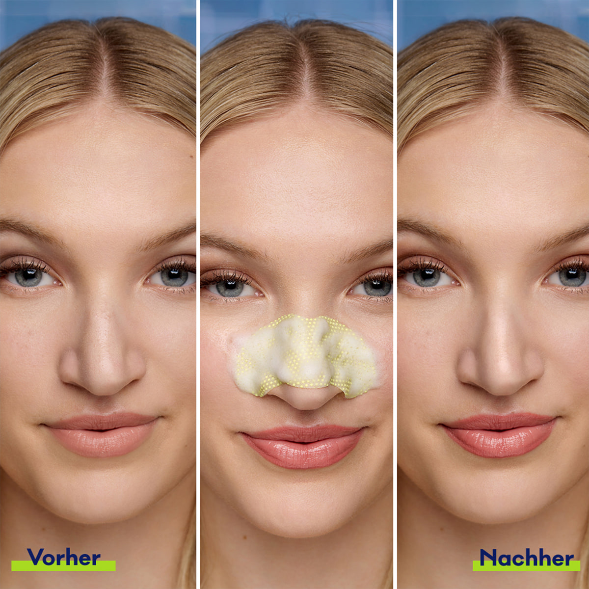 Porenverfeinernde Bubble Nasenmaske