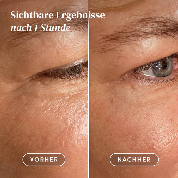 Wiederverwendbare Augen-Schläfen Pads mit Ectoin