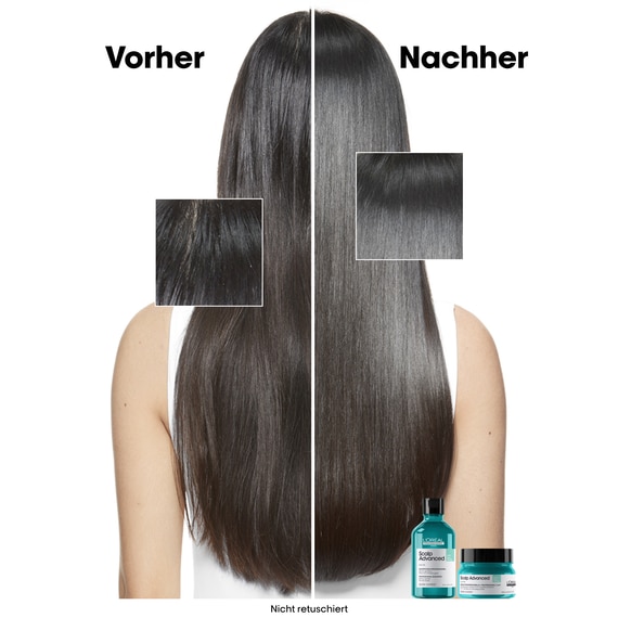 Scalp Advanced Anti-Oiliness Dermo-Purifier Shampoo