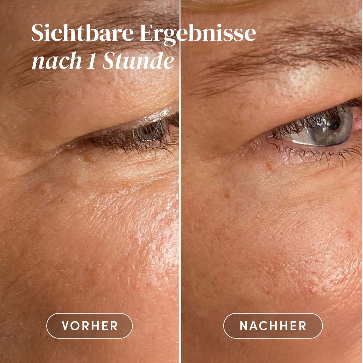 Wiederverwendbare Augen-Schläfen Pads mit Aloe Vera