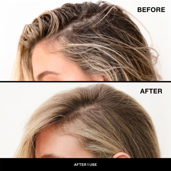 Charcoal Detox Dry Shampoo