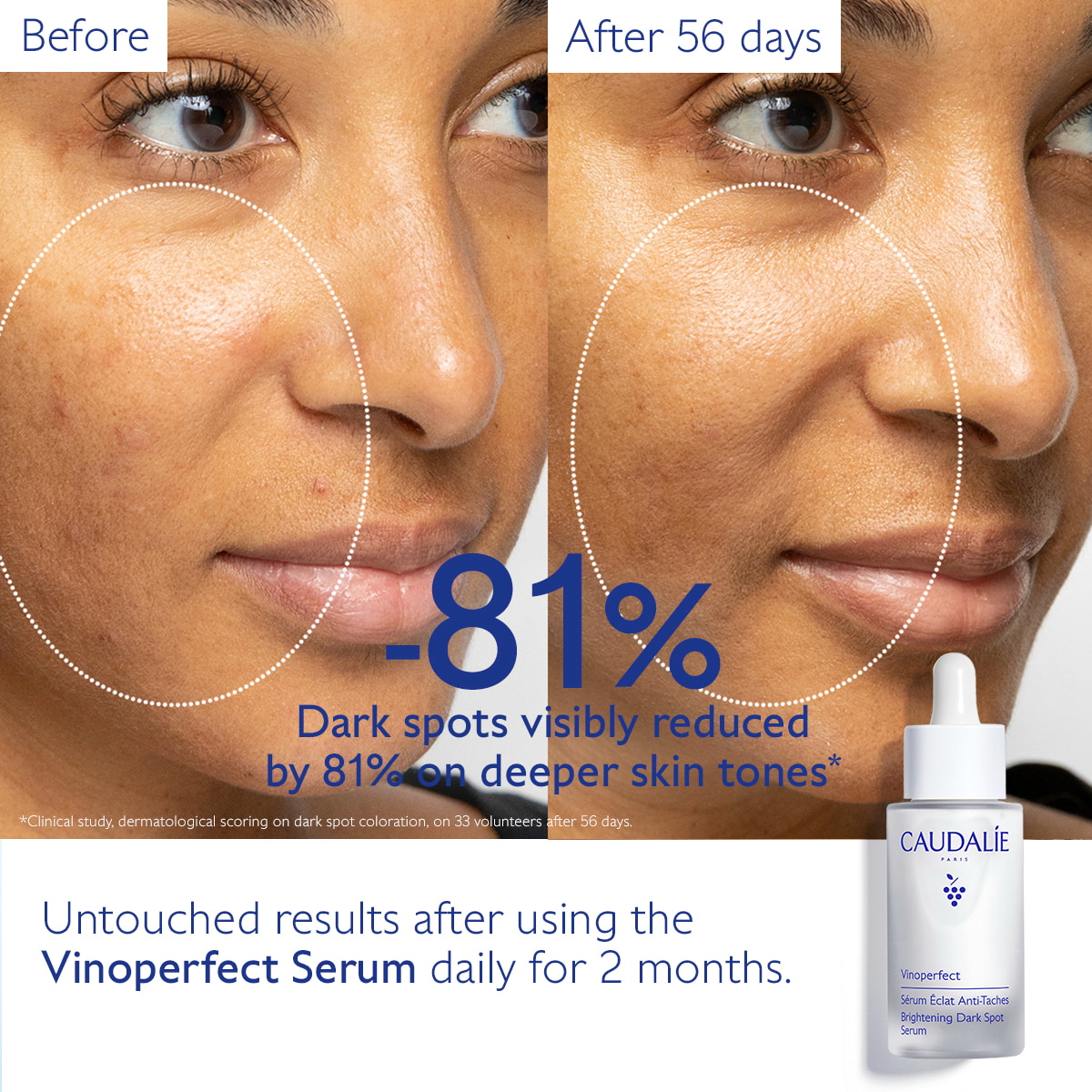 Brightening Dark Spot Serum