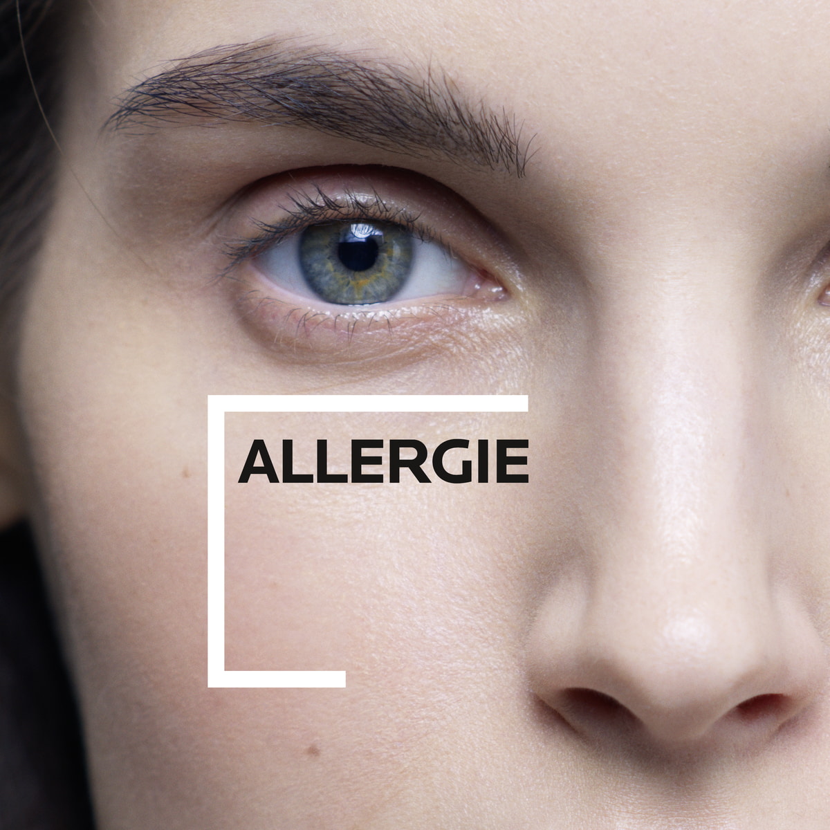 Dermallergo - Soothing Moisturizer