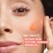 Siero Peeling