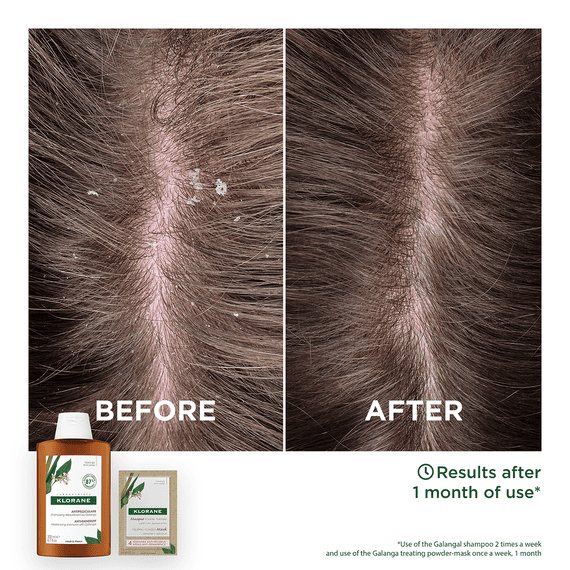Anti-Dandruff Shampoo