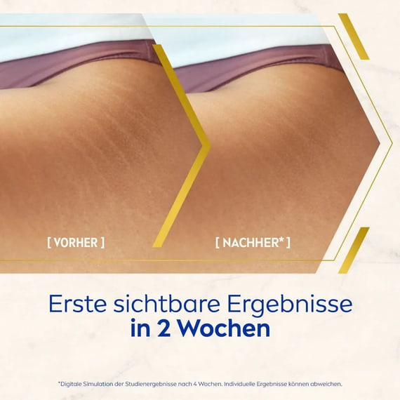 Olio-Siero Corpo Anti-Smagliature