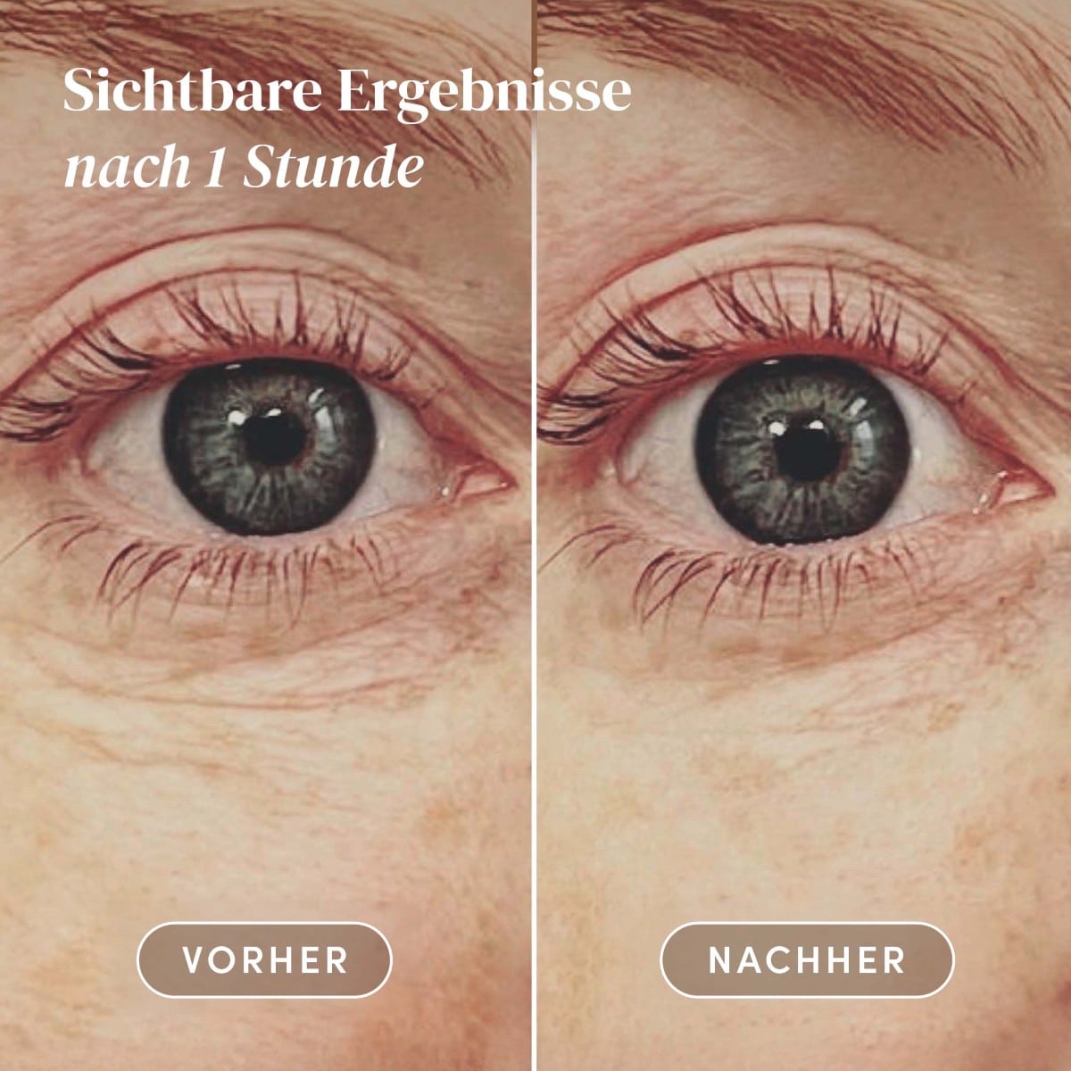 Wiederverwendbare Augen Pads Hyaluron „ocean eyes“