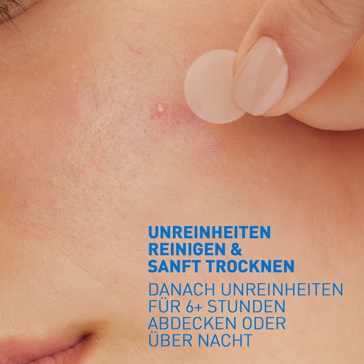 Anti-Unreinheiten Patches