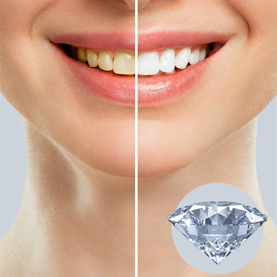 Diamond Toothpaste
