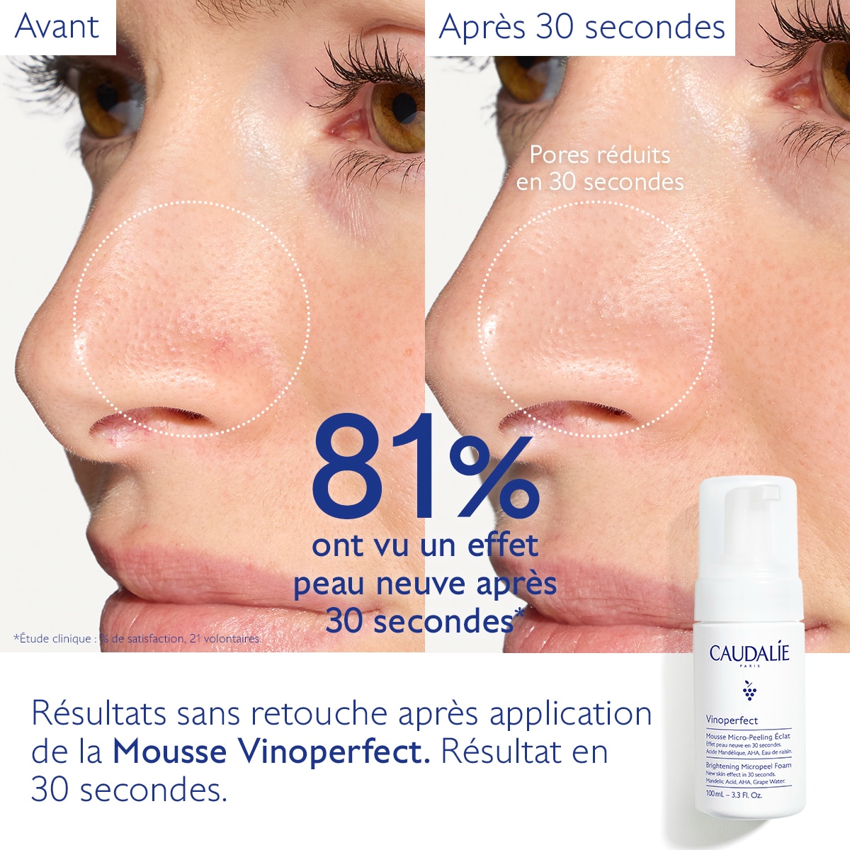 Mousse Micro-Peeling