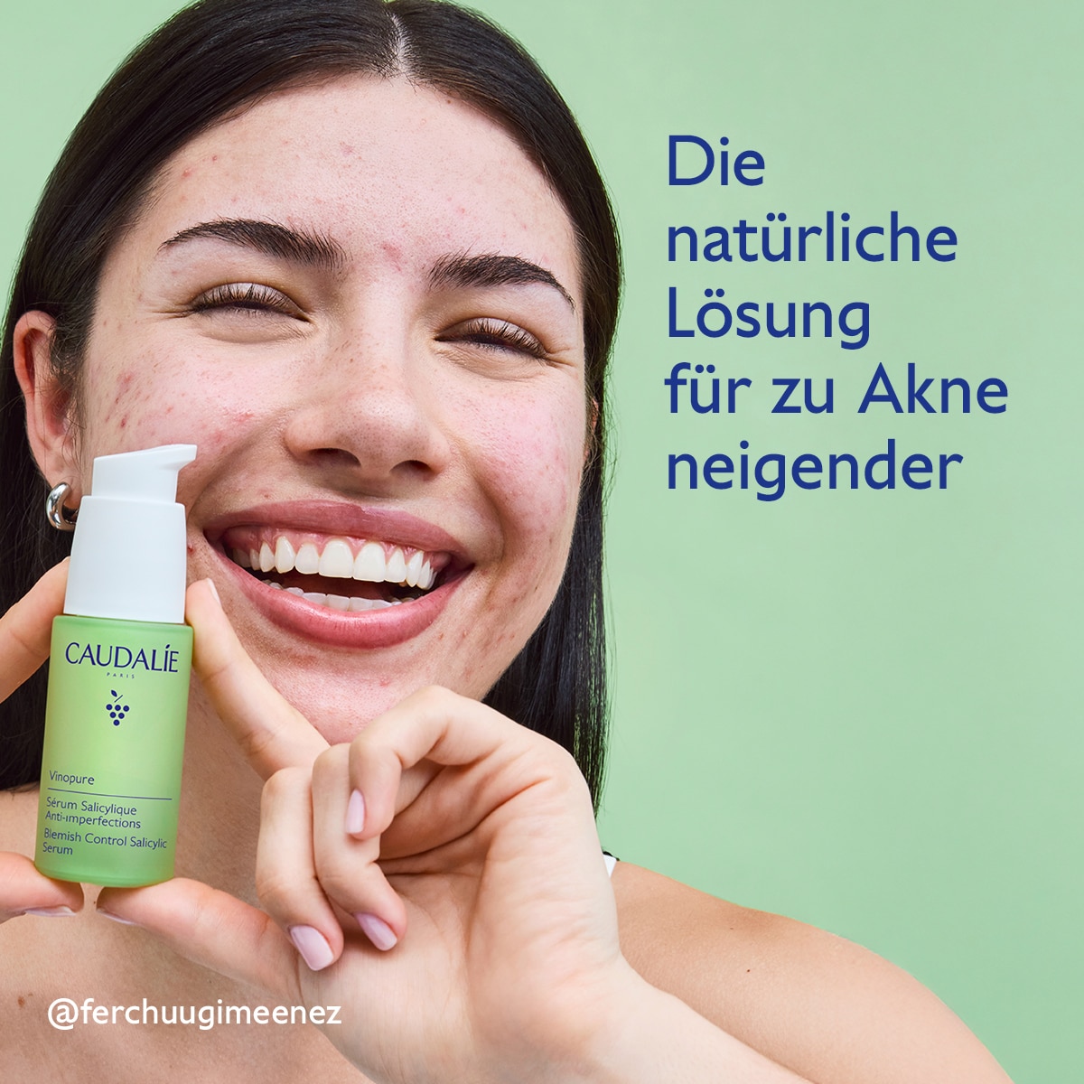 Serum gegen Unreinheiten