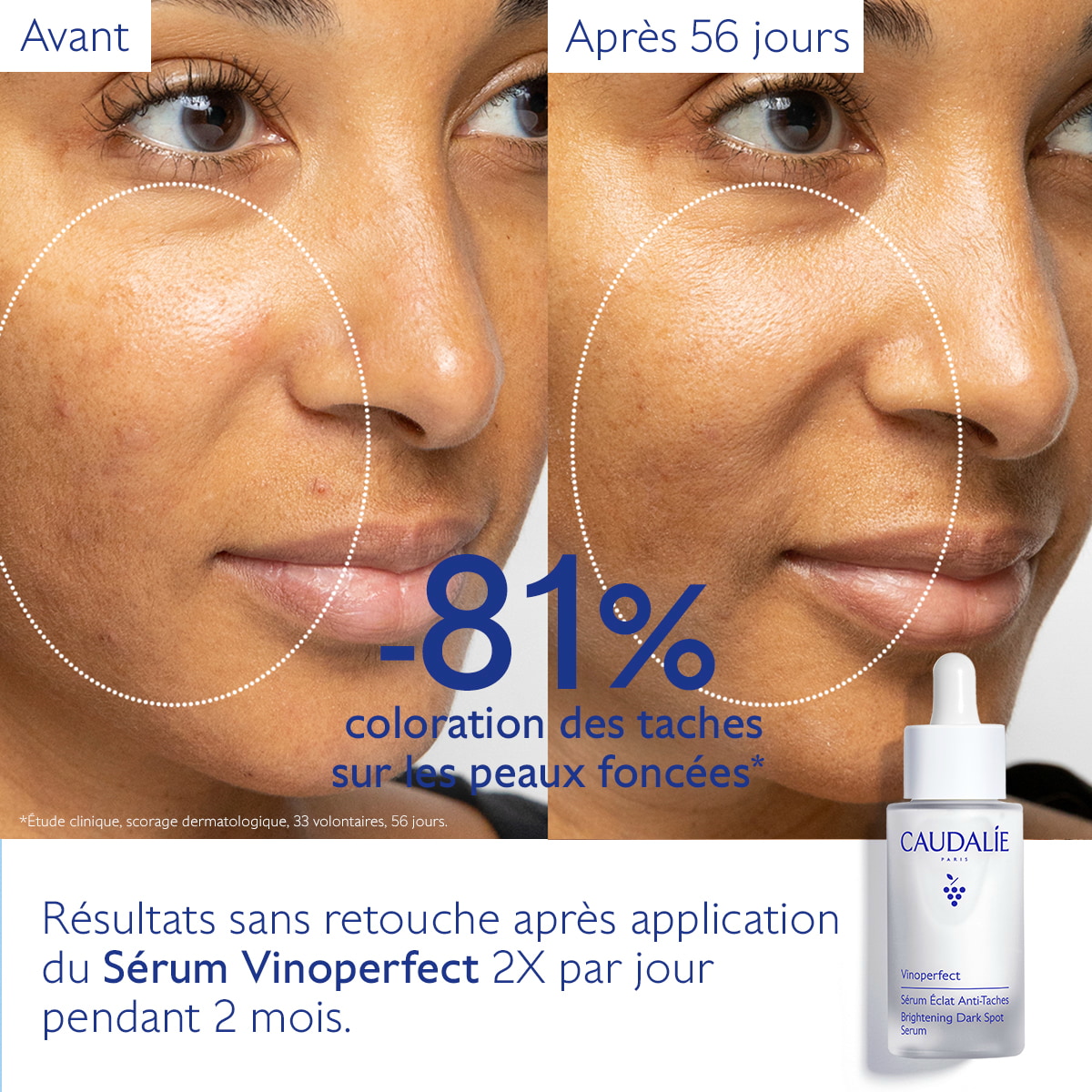 Sérum Éclat Anti-Taches