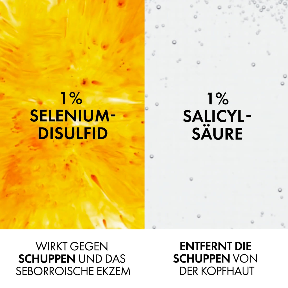 Anti-Schuppen Shampoo Trockene Kopfhaut