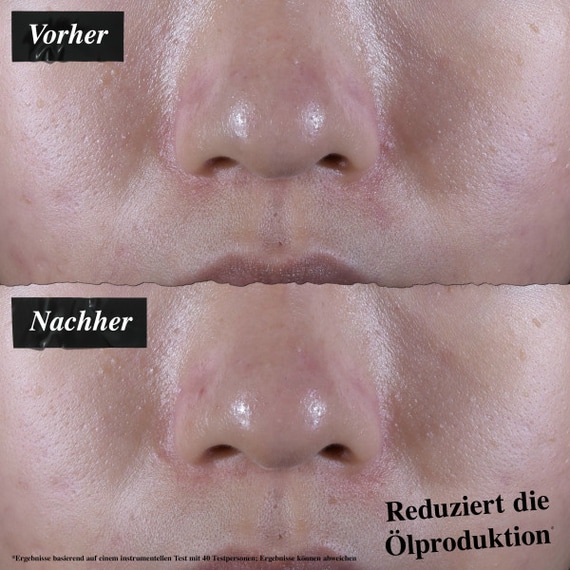 Ultra Facial Oil-Free Gel Cream