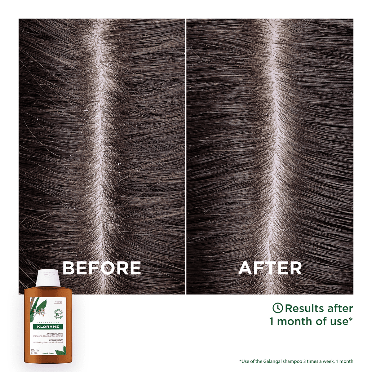 Anti-Dandruff Shampoo