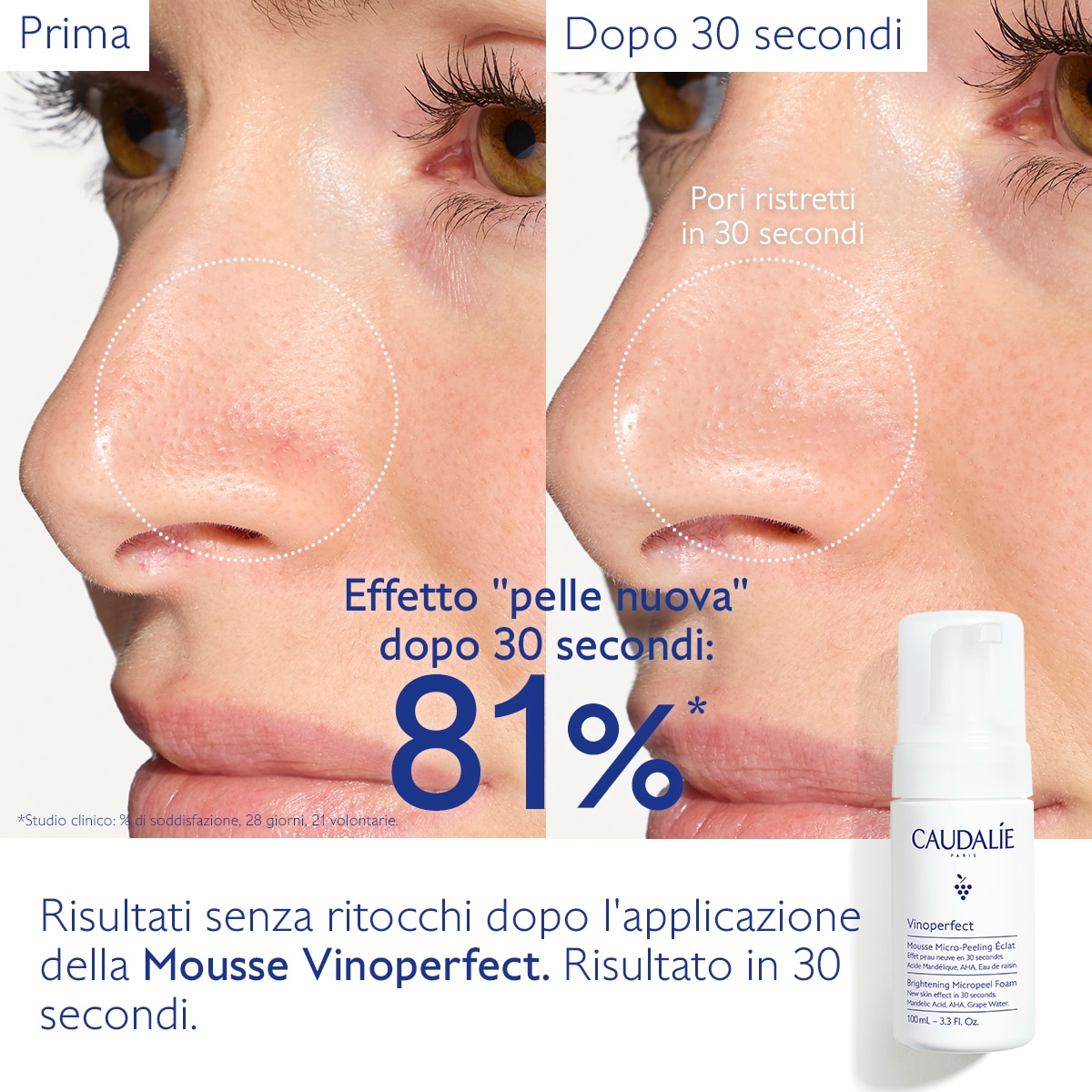 Mousse Micro-Peeling