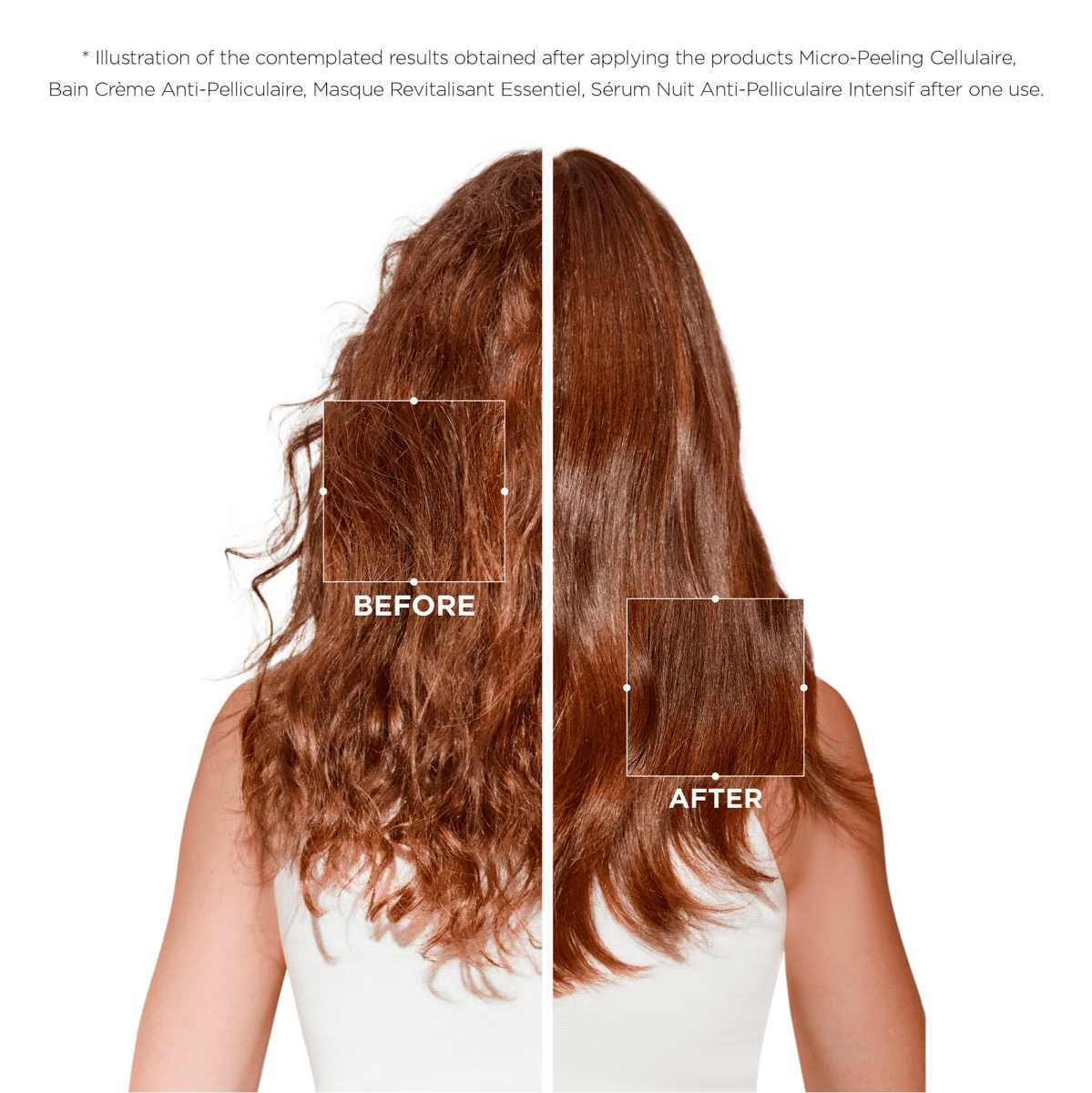 Micro-Peeling Cellulaire