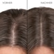 Anti-Schuppen Kopfhaut Serum
