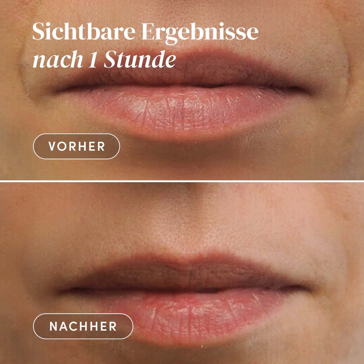 Mund-Patches mit Panthenol „smooth talker“