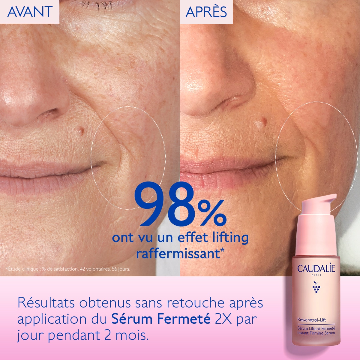 Sérum Liftant Fermeté