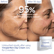 Dark Spot Niacinamide Moisturizer