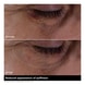 Double Serum Eye
