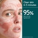 Instant Detox Mask