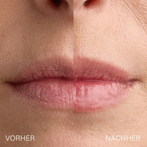 Lip Plumper