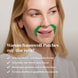  Mund Patches mit Aloe Vera