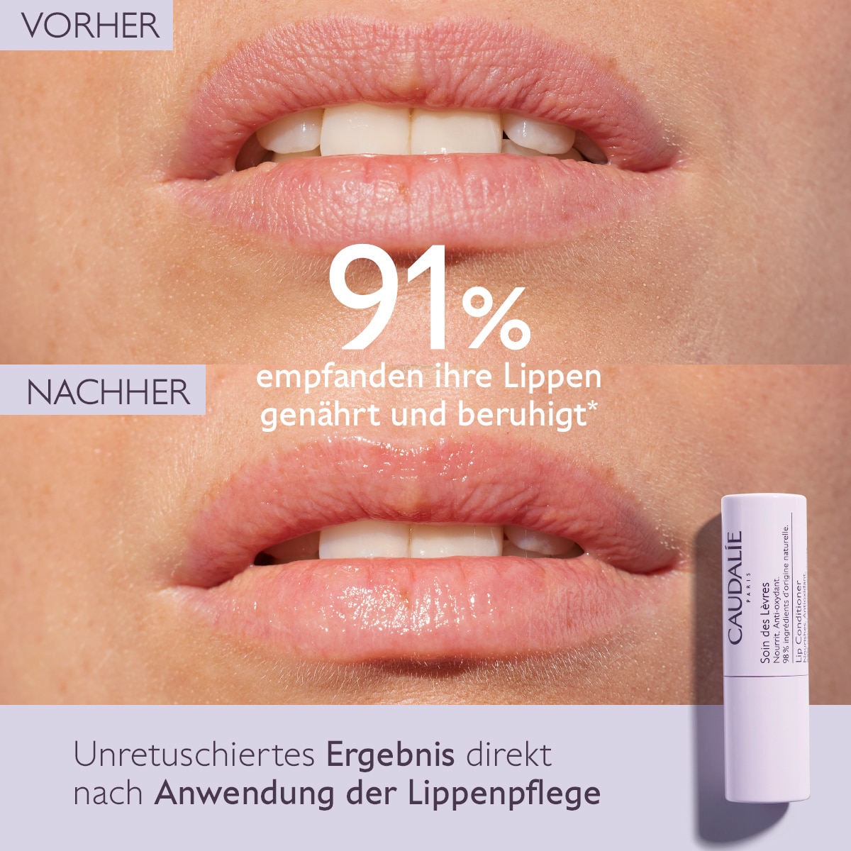 Lippenpflege