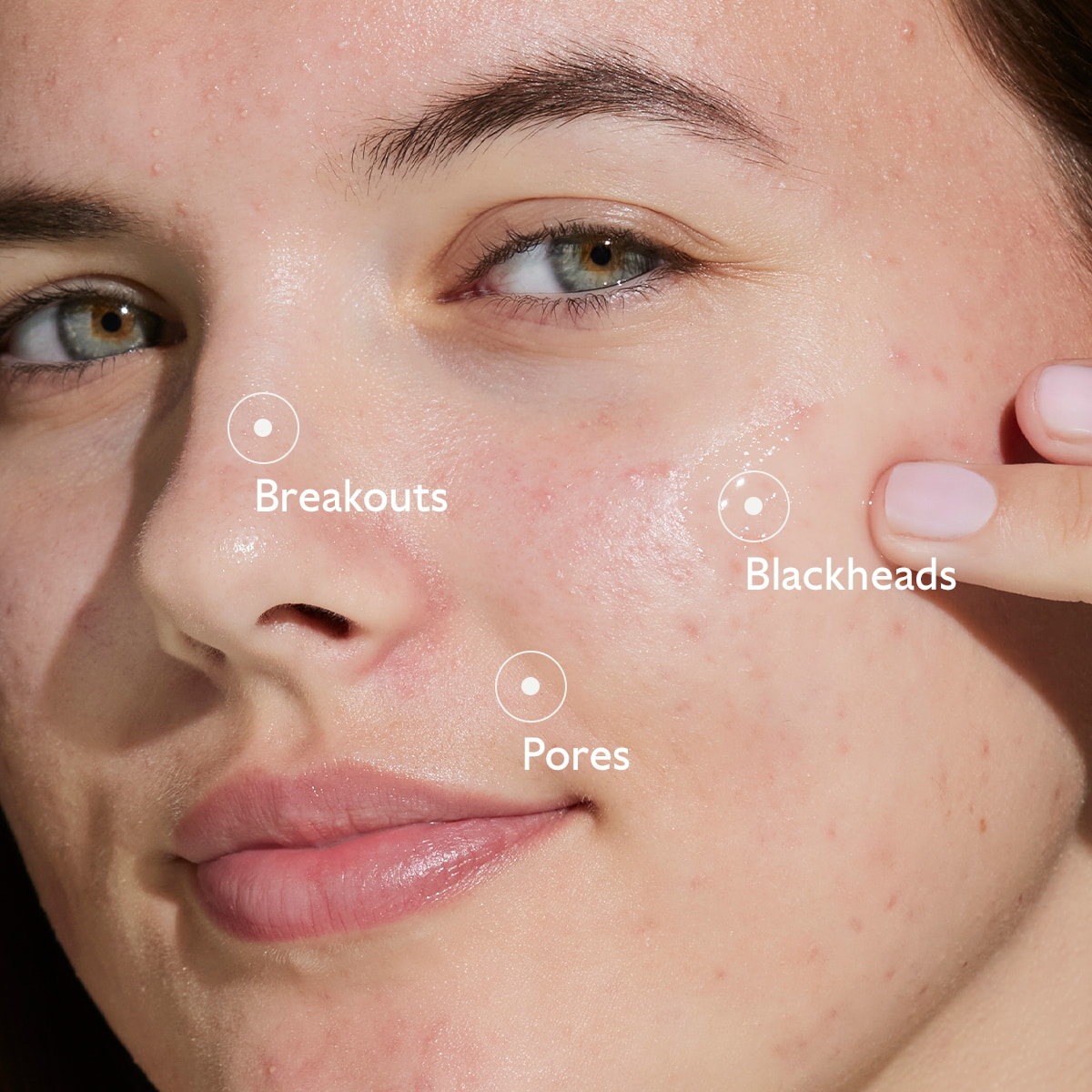 Blemish Control Serum