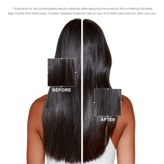 Micro-Peeling Cellulaire