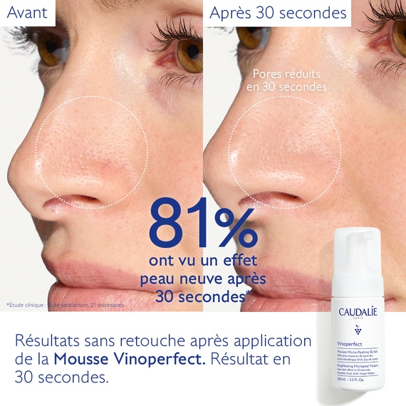 Mousse Micro-Peeling