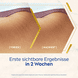 Olio-Siero Corpo Anti-Smagliature