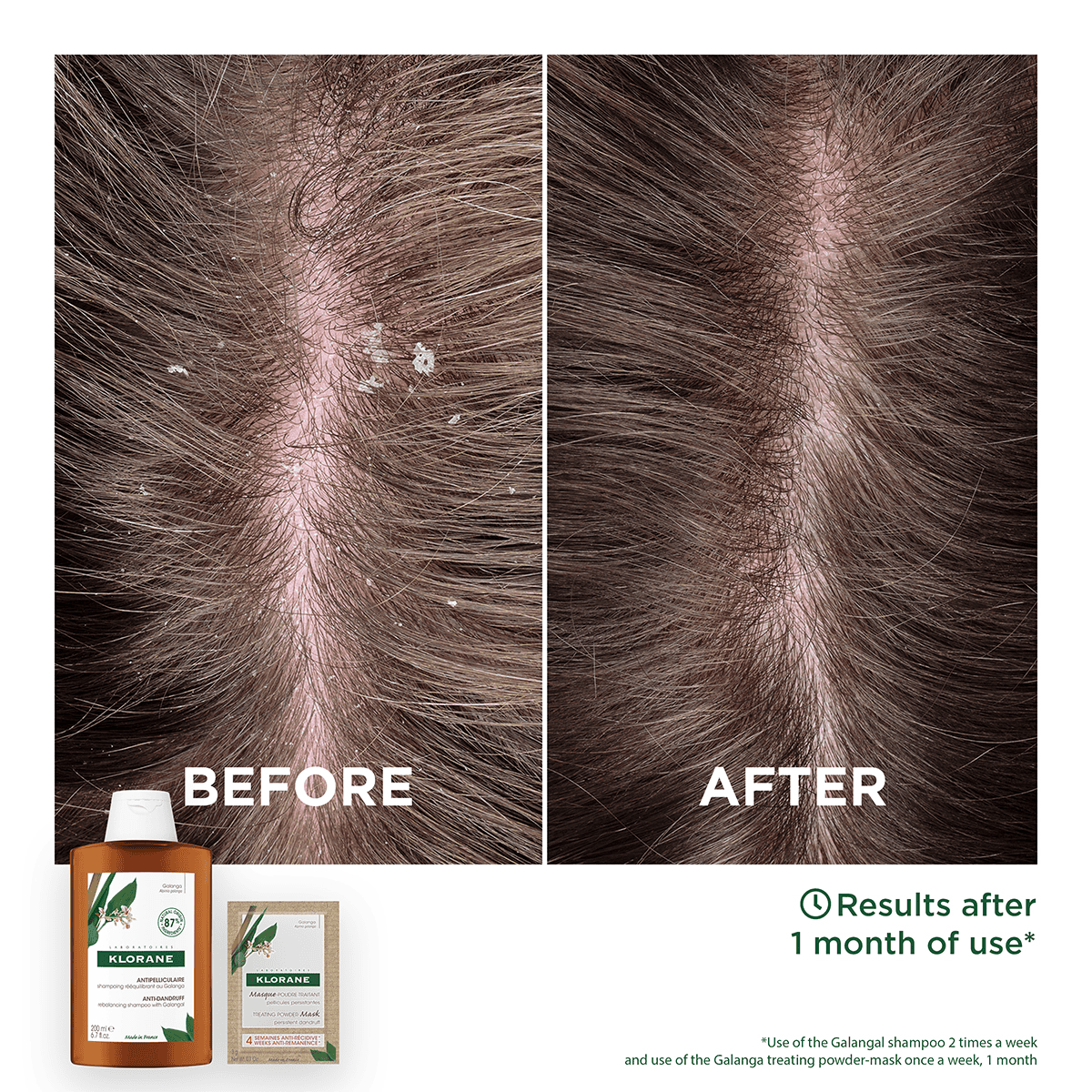 Anti-Dandruff Shampoo