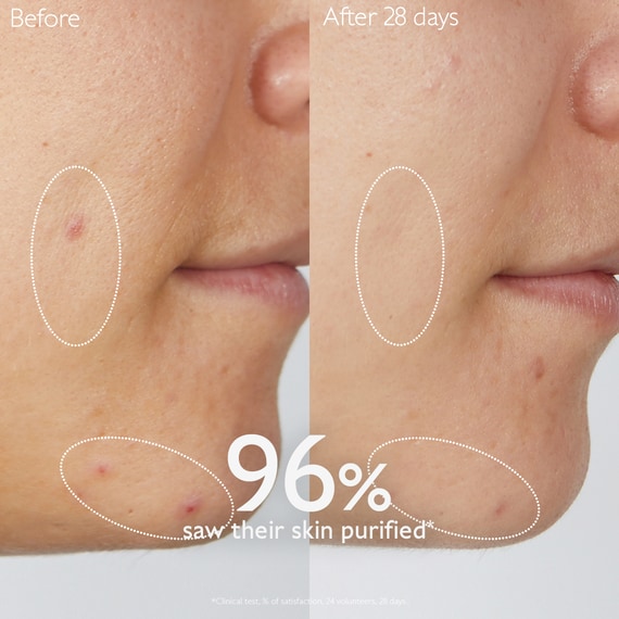 Pore Purifying Gel Cleanser