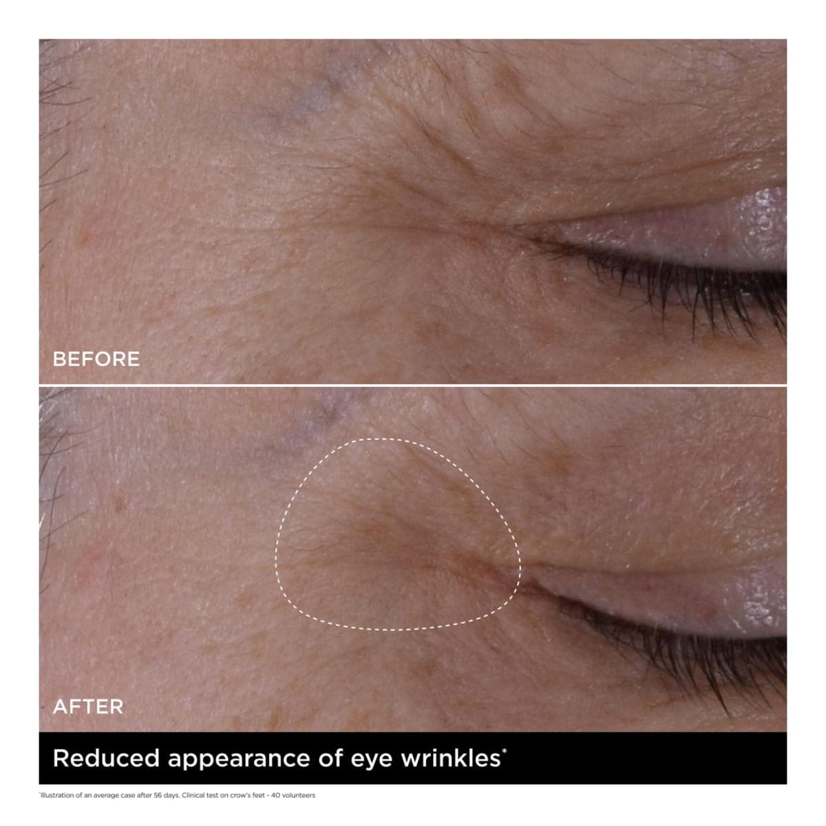 Double Serum Eye