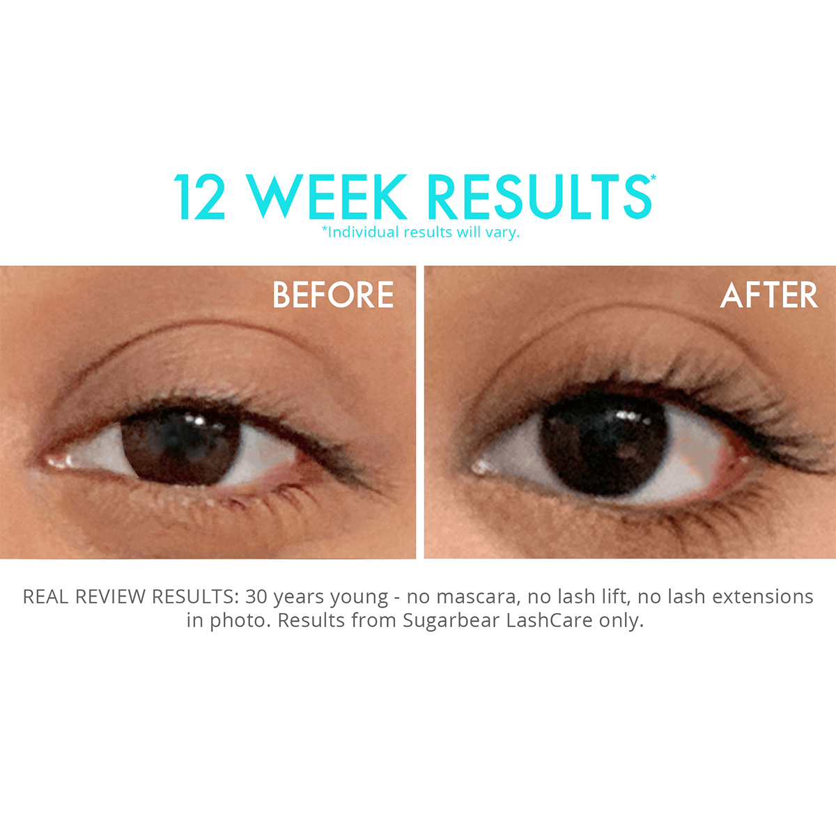 Sérum vitaminé Lashcare
