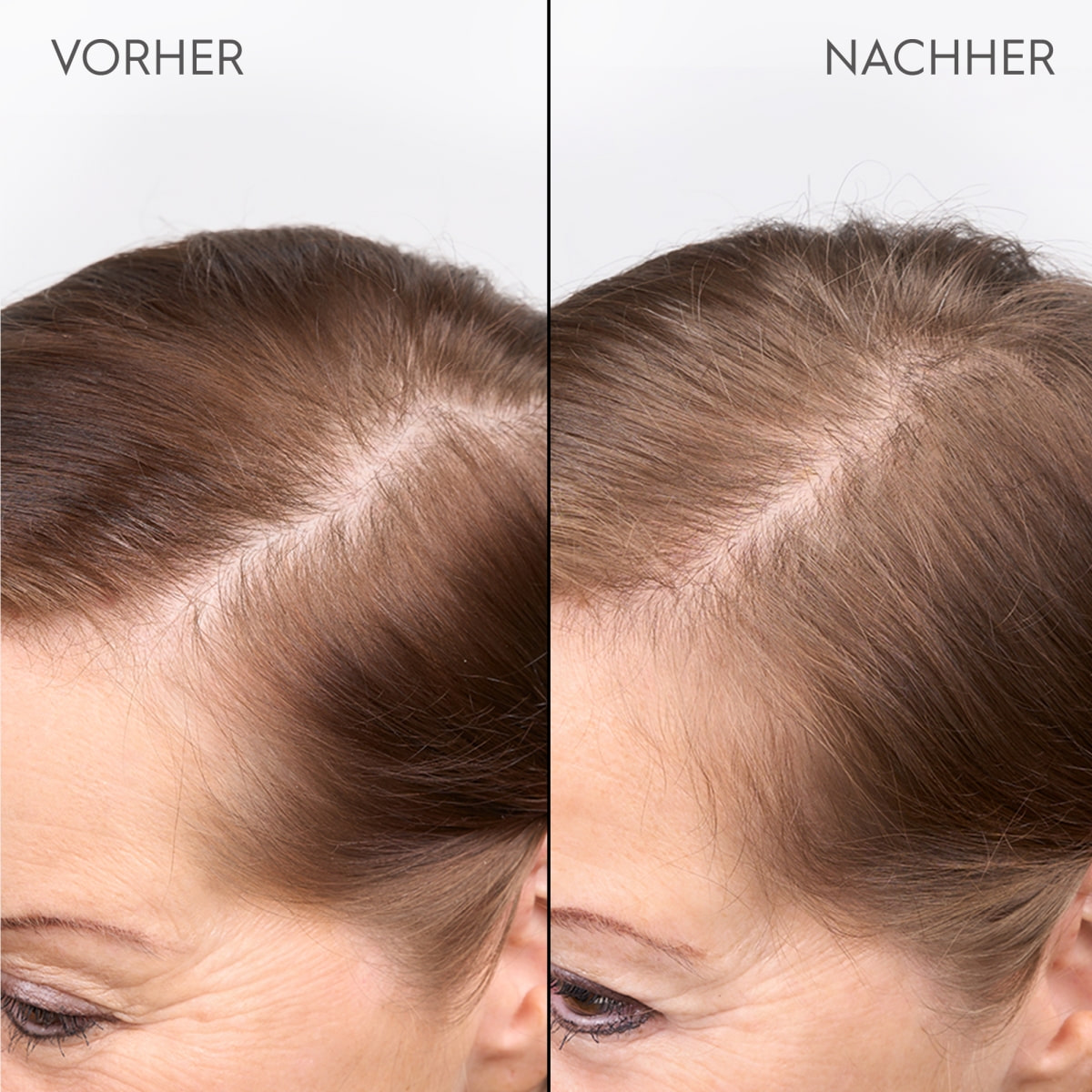 Densifying Scalp Serum