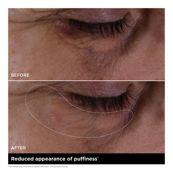 Double Serum Eye