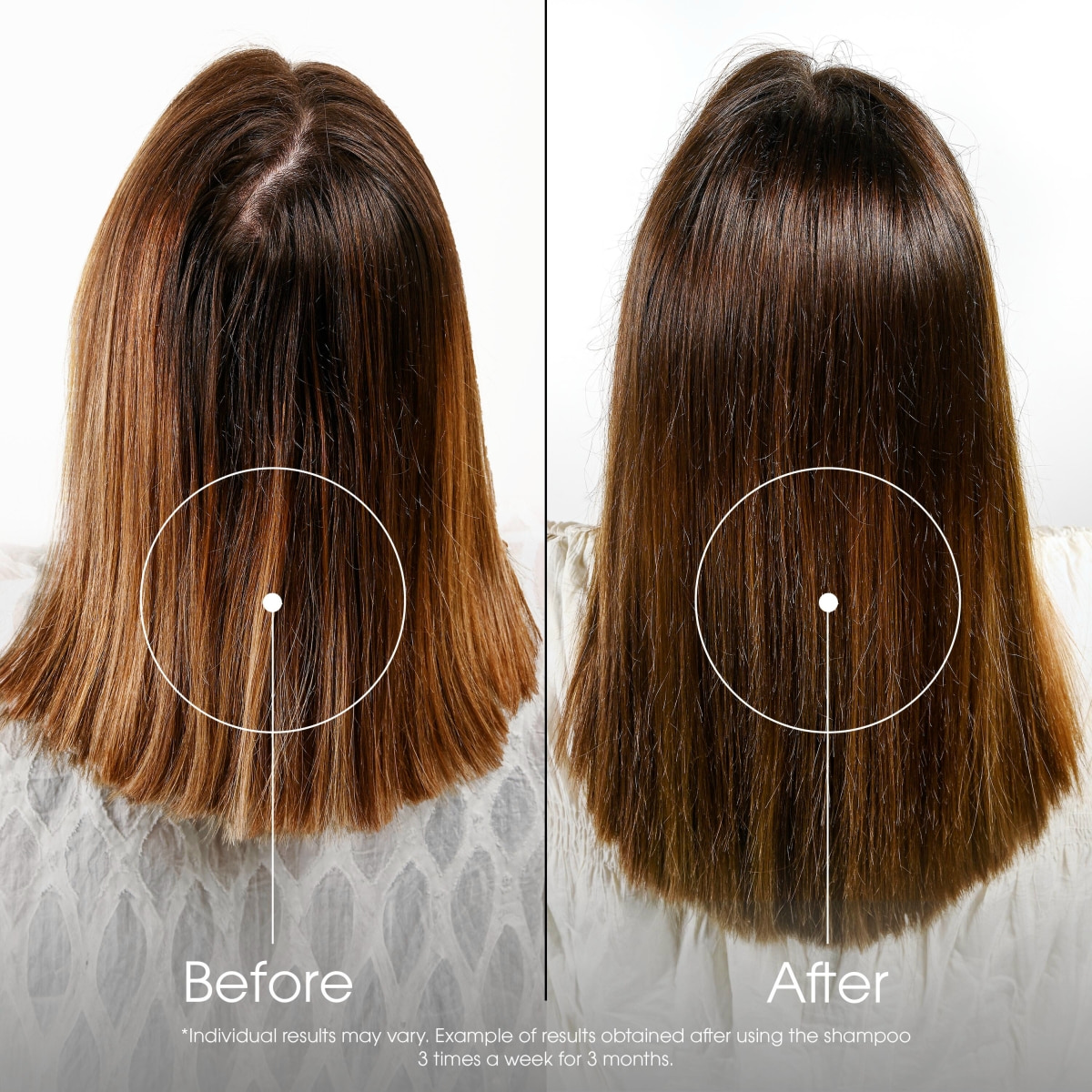 Shampoo for Hair Loss