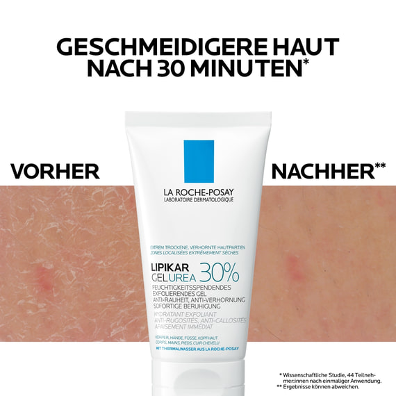 Feuchtigkeitsspendendes Exfolierendes Gel Urea 30%