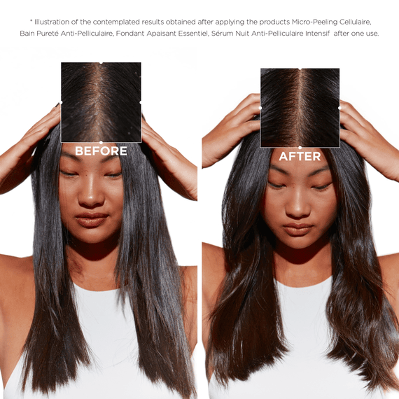 Micro-Peeling Cellulaire
